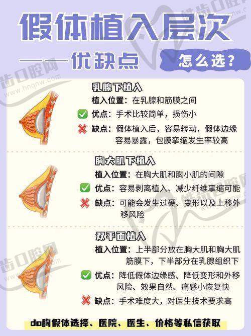 上海華美種植胡須真人實例二