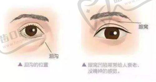 上海華美醫(yī)院皮膚科田院長(zhǎng)手法細(xì)致的體現(xiàn)