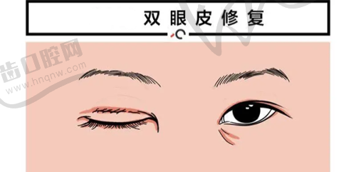 上海華美醫(yī)療美容醫(yī)院醫(yī)生審美風(fēng)格差異
