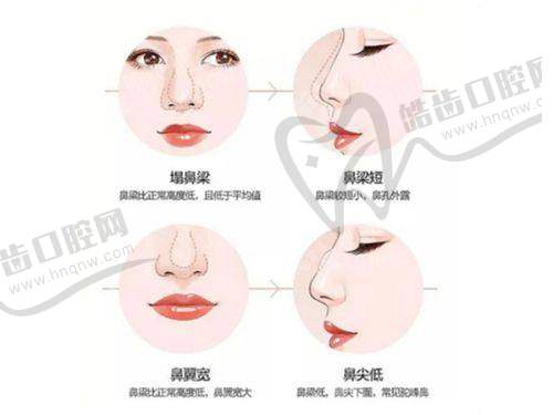 上海華美醫(yī)院口腔項(xiàng)目醫(yī)生與收費(fèi)