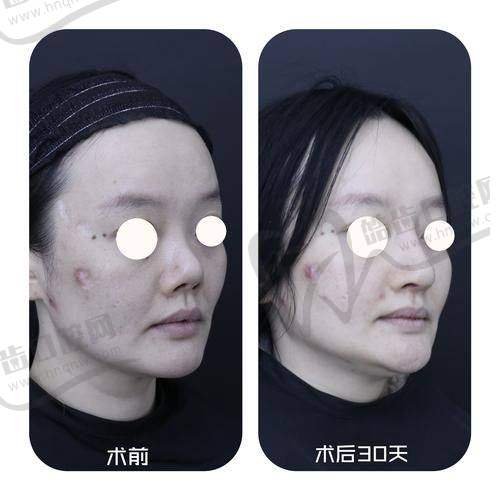 魏春华医生的独特技术优势