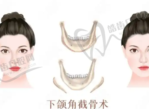 医院资质对丁丁注射玻尿酸费用的影响