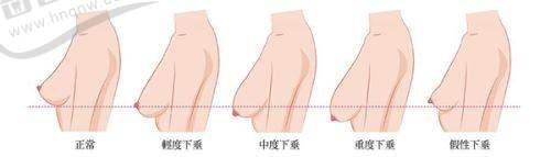 丁丁打玻尿酸能增長(zhǎng)多少：影響增長(zhǎng)成效的因素有哪些