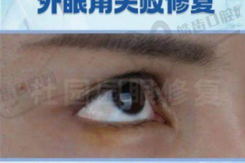 男性去势术怎样做手术：国内其他医院特色