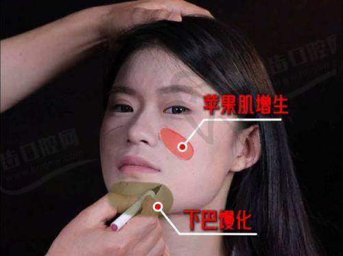 泰国咖蒙变性整形医院去势手术费用详情