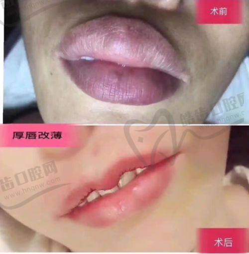 上海華美項(xiàng)目推薦醫(yī)生及技術(shù)優(yōu)勢(shì)
