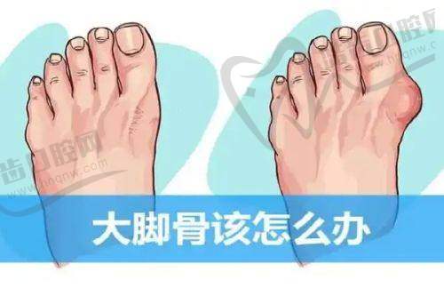 上海華美韓國品牌200單位瘦腿項目推薦醫(yī)生——孫慧英