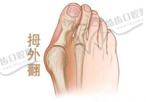 泰国曼谷雨整形去势手术费用明细