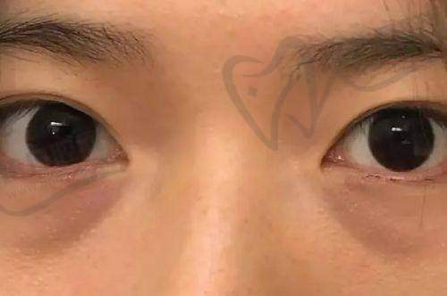 男士玻尿酸增大多少钱：部分城市价格参考