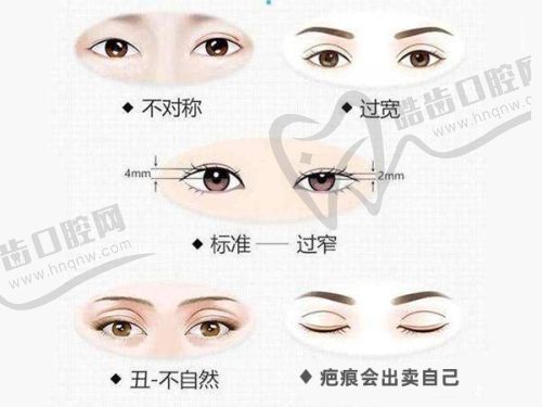 上海華美與韓國品牌200單位瘦肩項目相關(guān)其他類型收費價格參考