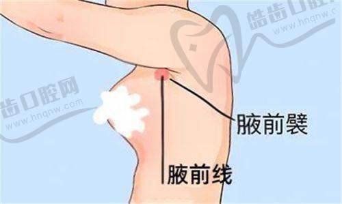 男性去势手术费用情况：国内收费标准解析
