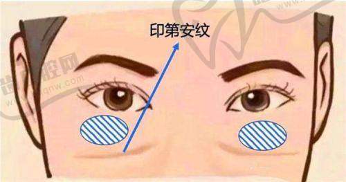 上海華美韓國品牌200單位瘦肩項目真人實例
