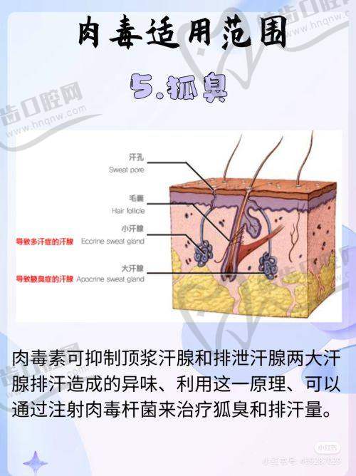 上海華美韓國品牌200單位瘦肩項目預(yù)約掛號攻略