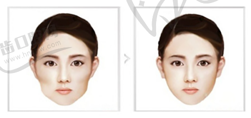 上海华美全口检查技术优势大揭秘