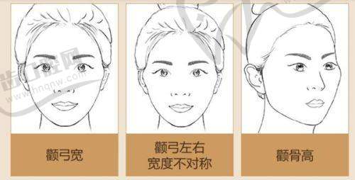 丁丁打玻尿酸不同医院收费情况