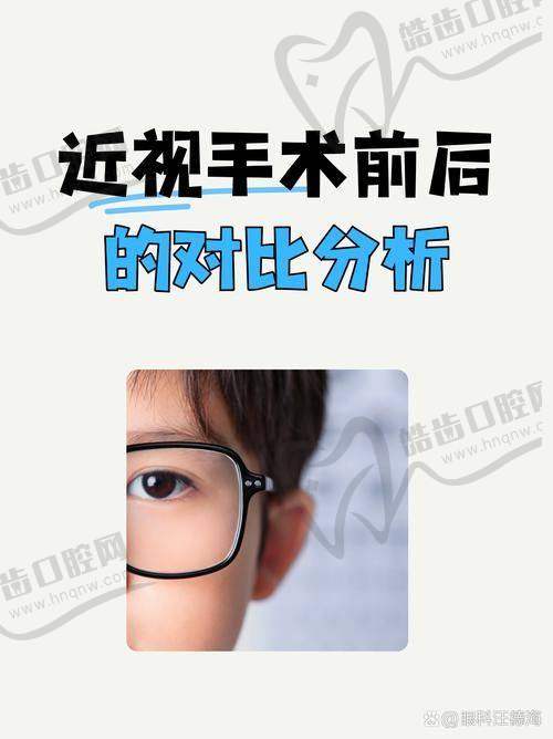 四、真实患者口碑：3位高度散光患者的“摘镜”蜕变记