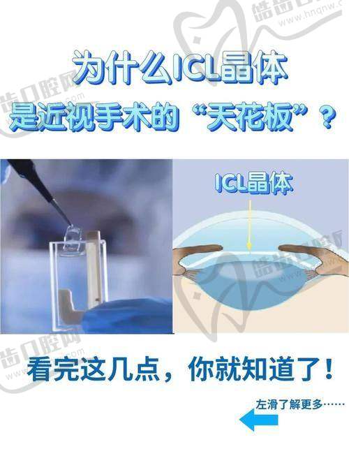 三、TICL带散光晶体植入术8大核心优势：为什么高度散光患者更选它？