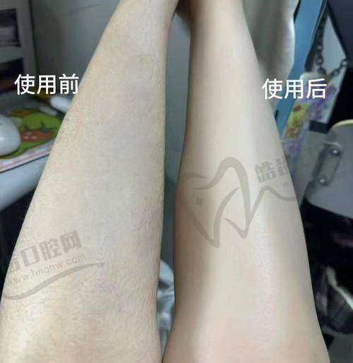 大连雅婷医疗美容门诊部：综合医美，脱毛专精