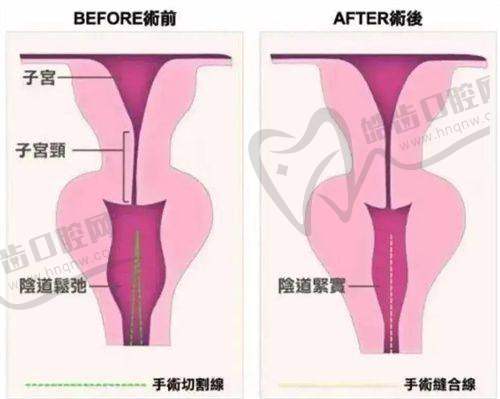 上海颜净医疗美容门诊部杨建国面部注射提升经验优势