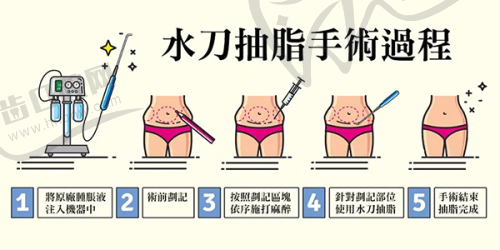河南南阳天伦医院私密科男士入珠的亮点与价格区间