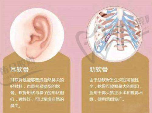 医生经验对海绵体注射价格和维持时间的作用