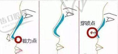 普丽兰的核心成分：源自韩国三文鱼的奥秘