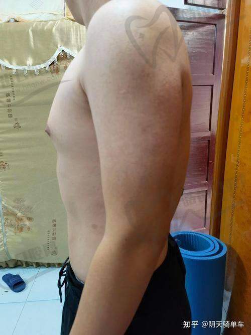 北京大学人民医院男科张国喜医生怎么样?三十年专注男性难题