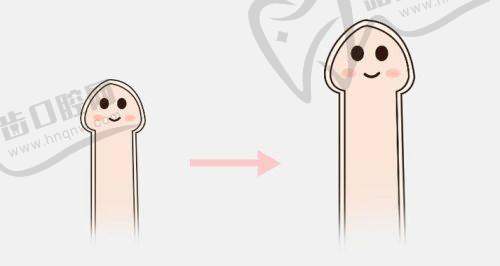 北大人民医院男科医生张国喜怎么样？多种男科手术价目透明，挂号方式超全一文知晓！