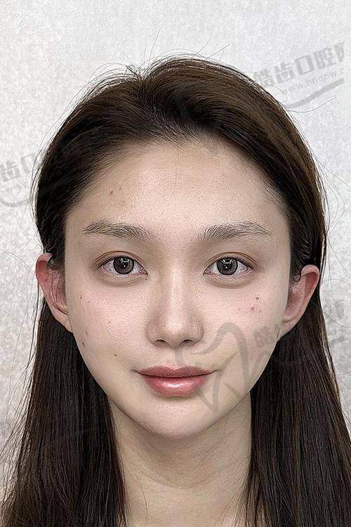 瑞藍定采和喬雅登豐顏哪種更適合你？結(jié)合實例推薦：