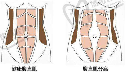 肖林正颌:成效与价格揭秘