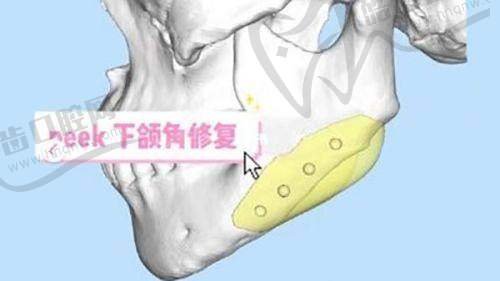 整形美容医院在线询问-24小时北京上海广州整形美容医院免费询问：免费询问的热门项目及对应医院