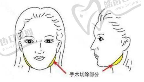 整形美容医院在线询问-24小时北京上海广州整形美容医院免费询问：在线询问的注意事项