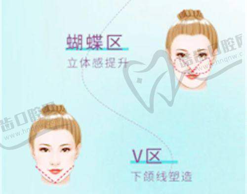 腋臭手術(shù)后會(huì)復(fù)發(fā)嗎？成都西部中西醫(yī)結(jié)合醫(yī)院的技術(shù)與復(fù)發(fā)情況