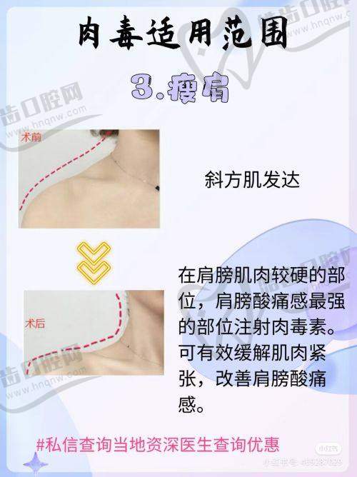 腋臭做手术可以完全有效治疗吗？术后修复感受分享