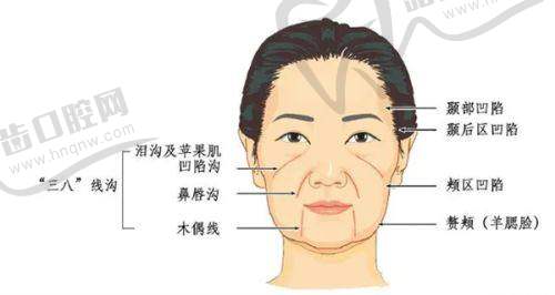 皮肤管理（热玛吉治疗）对比