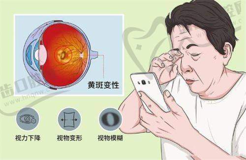5. 淮安近视手术隐藏费用指南：这些钱不能省