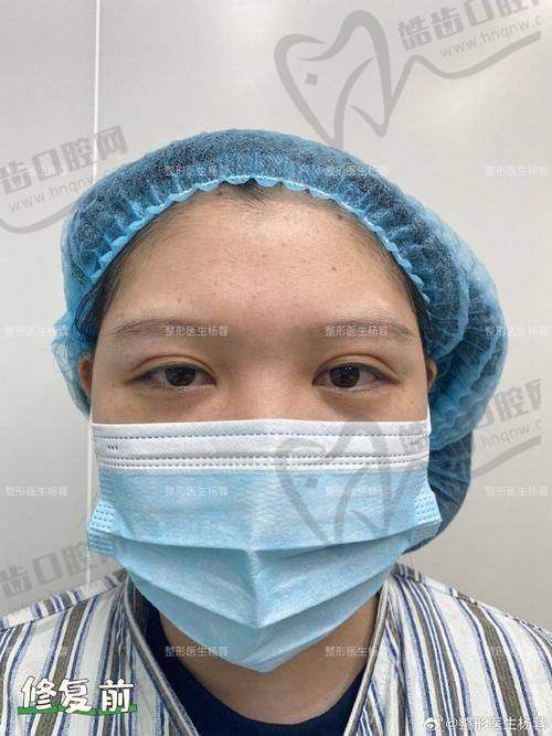 上海悦目佳容医疗美容门诊部（原上海玺美）特色项目及技术优势