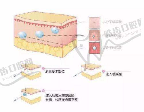 杭州薇琳医疗美容医院徐少骏医生：专精背景突出，圈内公认的实战派骨干医生