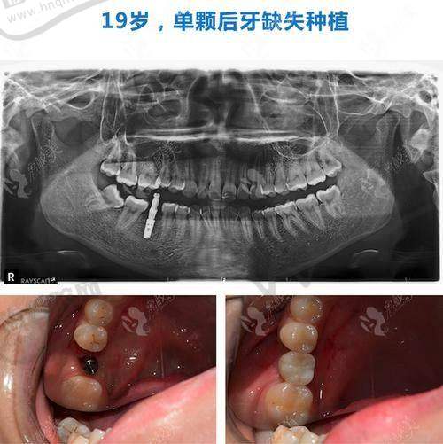 周航院长技术优势