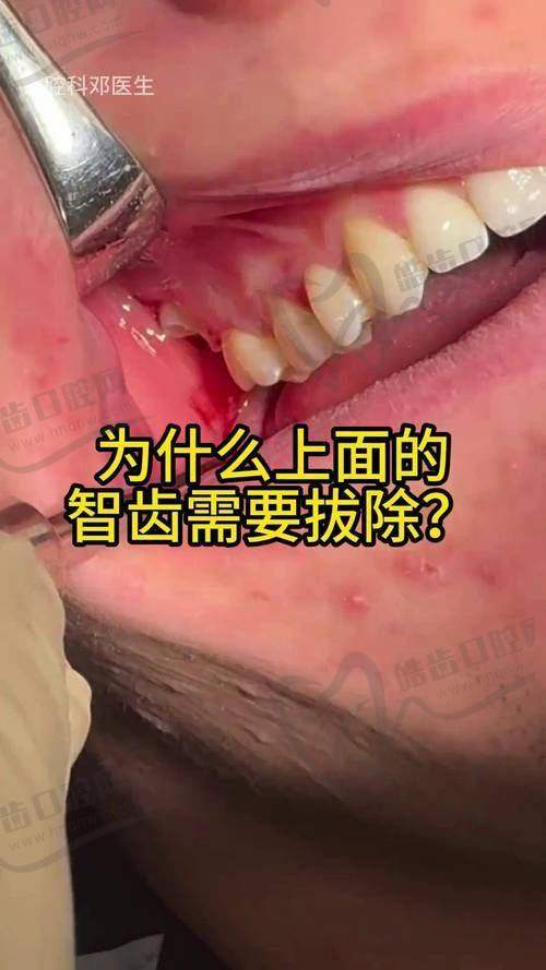 白爽医生擅长项目