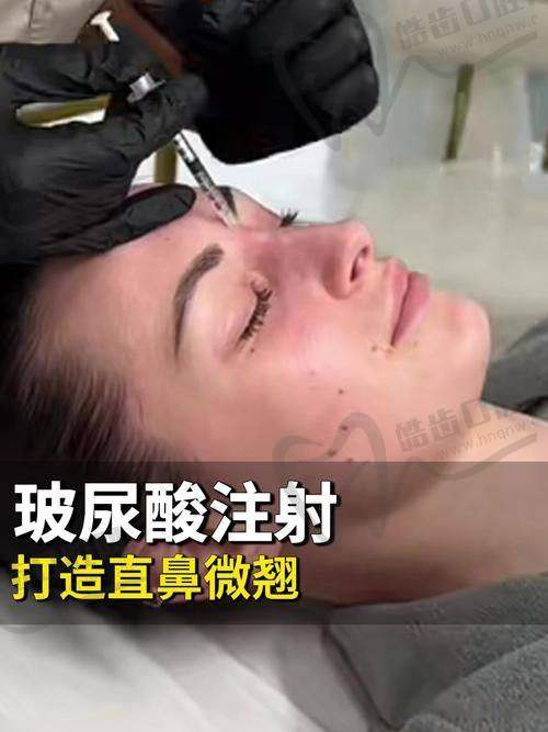 润致3号玻尿酸适合打哪里？应用区域全解析
