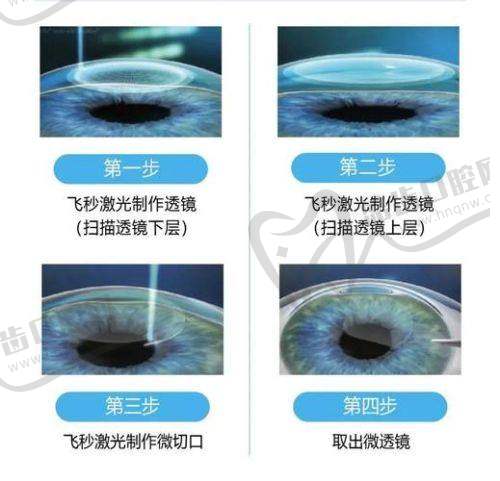 杭州市萧山区第三人民医院眼科价格表