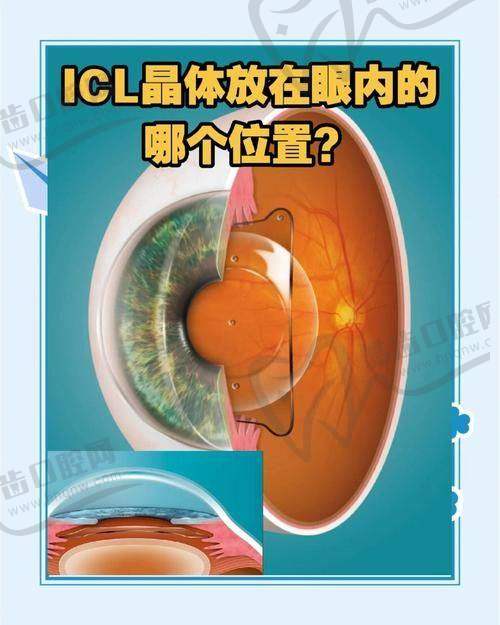 深圳市第二人民医院眼科基本信息
