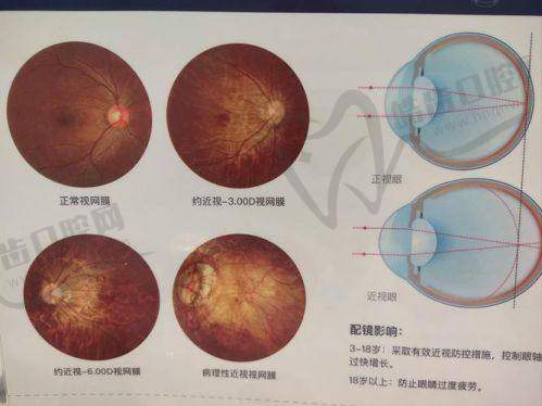 北京大学深圳医院眼科正规吗？