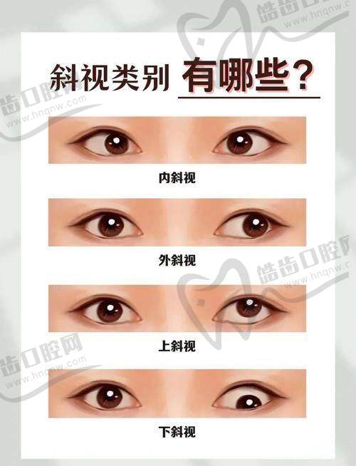 昆山爱尔眼鼻喉医院预约挂号