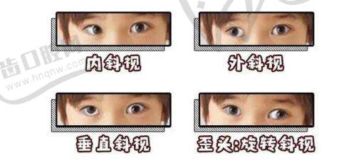 杭州市萧山区第三人民医院眼科预约挂号