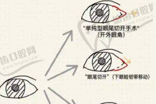 广州丽合润致娃娃水光针2000元起，深层补水3个月，干纹细纹一键清零！