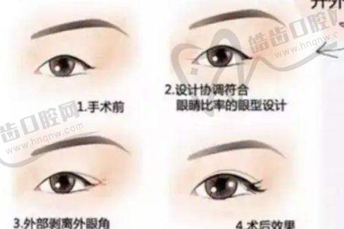 一、南宁亚太医疗美容医院怎么样？