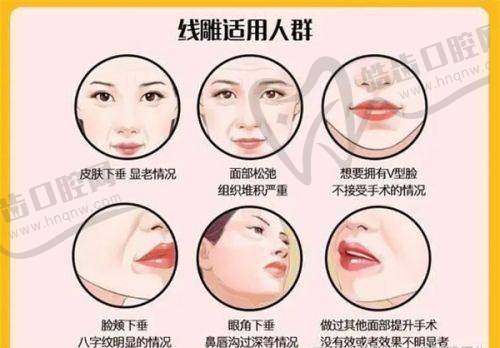 三、轻薄针适合哪些人群——精细匹配需求
