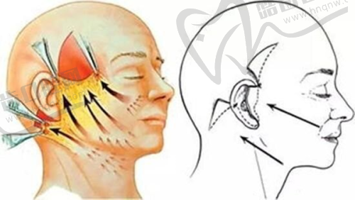 七、脸上打轻薄针几天出成效：如何科学判断成效是否稳定